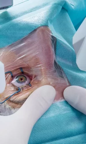 laser_eye_surgery-a7551adb99784add9e388179cc68b3c7